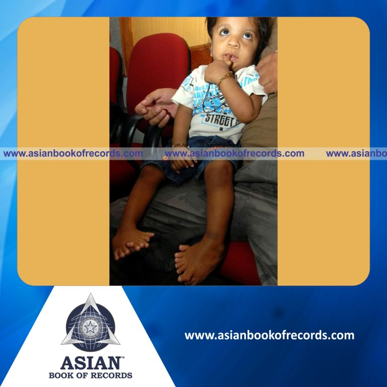 Highest Number of Fingers and Toes by Birth